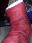 Cast 